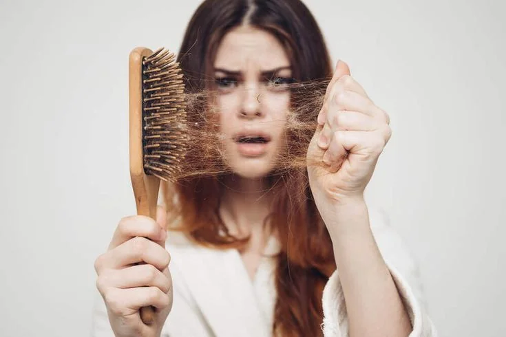 alopecia-efluvio-telogeno
