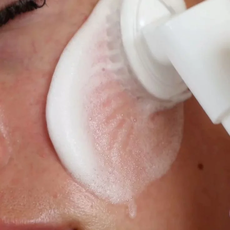 Limpieza facial profunda